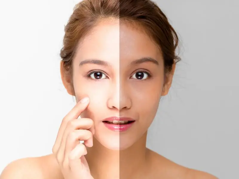 Skin Lightening 2 Whitening.webp